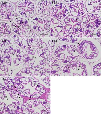A multi-angle analysis of injury induced by supplementation of soybean meal in Litopenaeus vannamei diets